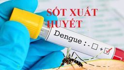 Những lưu ý quan trọng trong mùa dich sốt xuất huyết